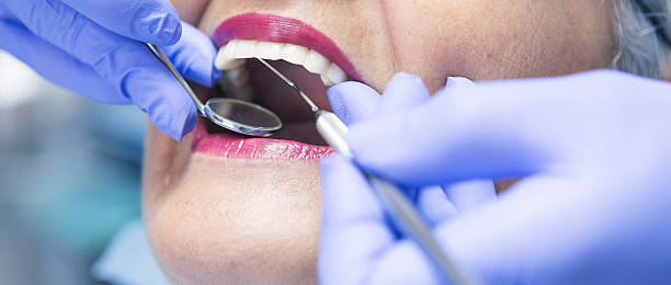 Best Emergency Wisdom Teeth Removal in Cascade Valley, WA